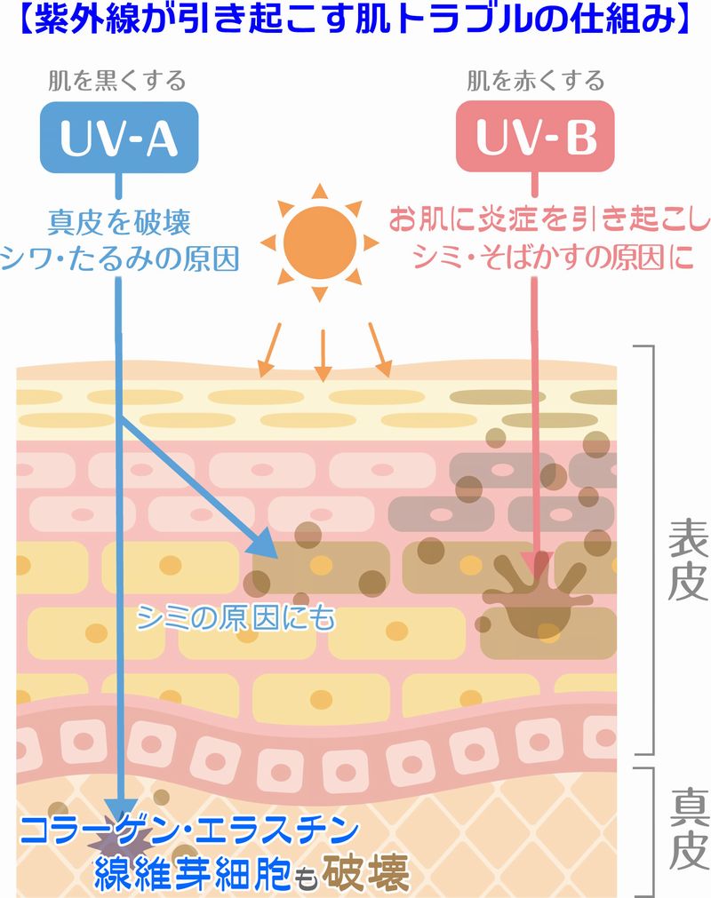 UV-AとUV-Bが引き起こす肌トラブル